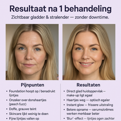 De #1 Dermaplaning Tool voor Vrouwen van 50 +