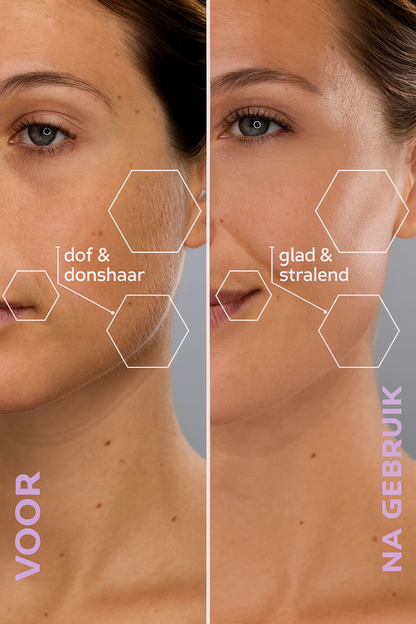 De #1 Dermaplaning Tool voor Vrouwen van 50+